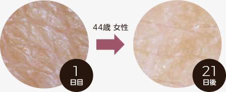 肌の新細胞の量が284％促進するEGF成分10％配合